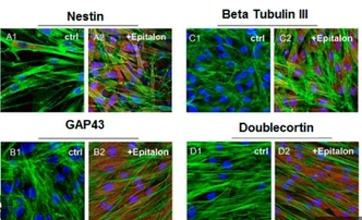 Epitalon Stimulates Gene Expression and Protein Synthesis during Neurogenesis Epitalon Stimulates Gene Expression and Protein Synthesis during Neurogenesis